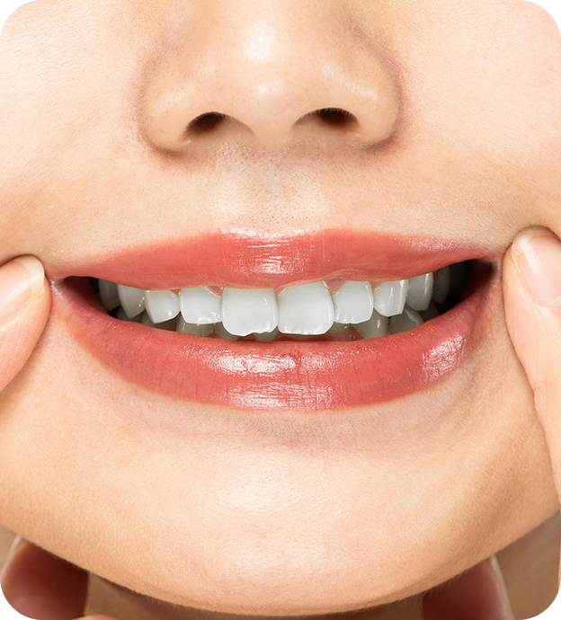 white teeth